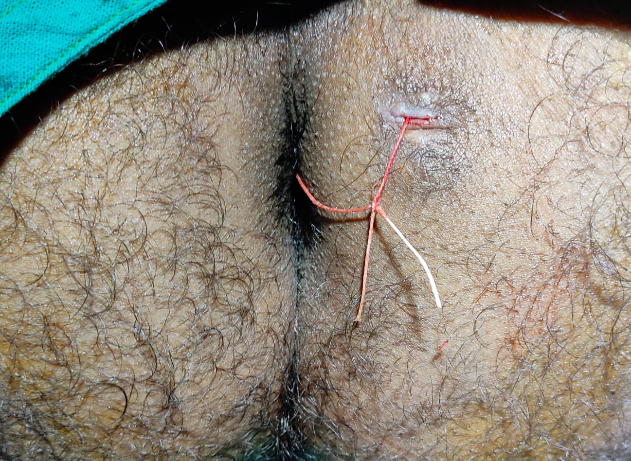 Treatment Result 1