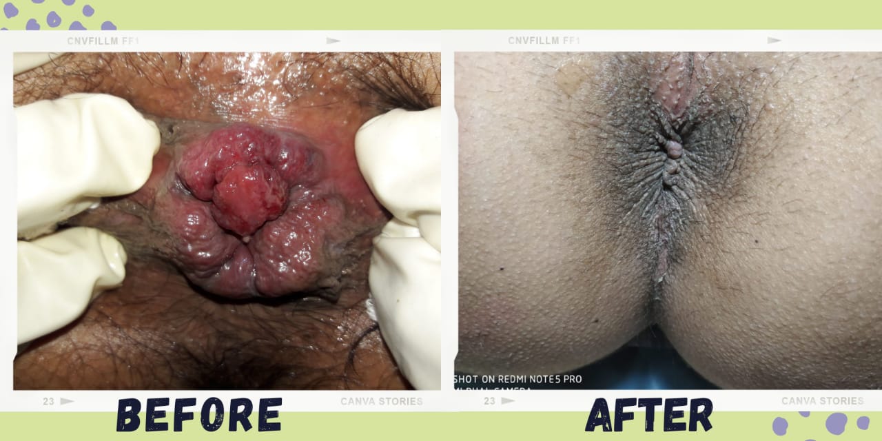 Treatment Result 2